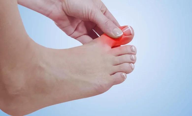 ayak baş parmak ağrısı