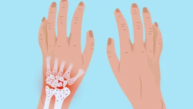 sol el bilek ağrısı