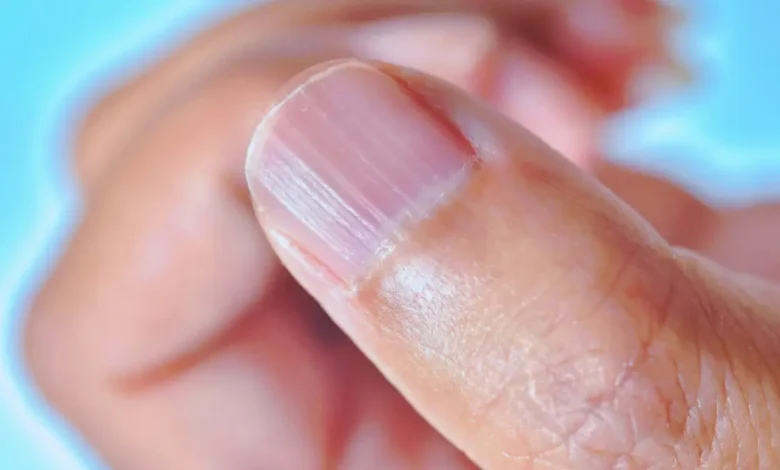 baş parmak tırnak ağrısı