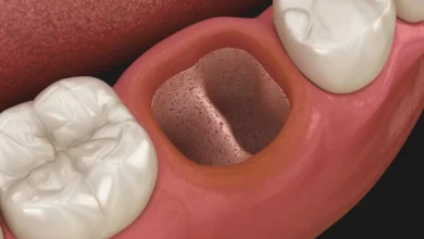 dişimi çektirdim hala ağrıyor ne yapmalıyım