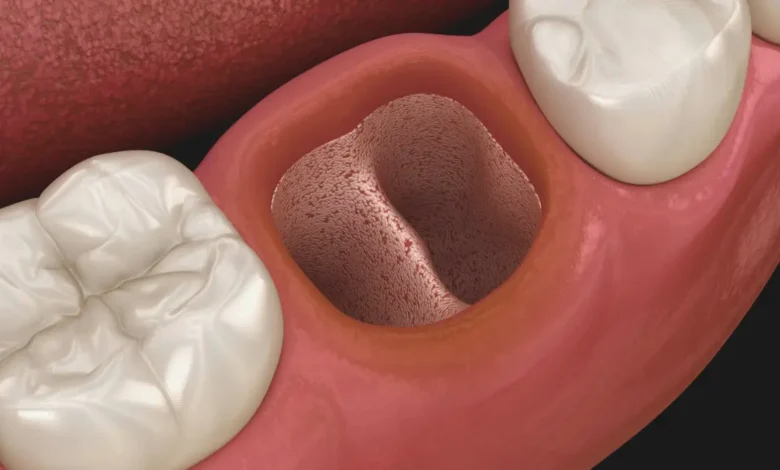 dişimi çektirdim hala ağrıyor ne yapmalıyım