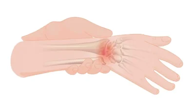 el bileği ağrısı