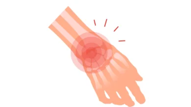 sağ bilek ağrısı