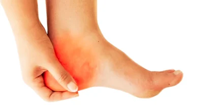 arka topuk ağrısı