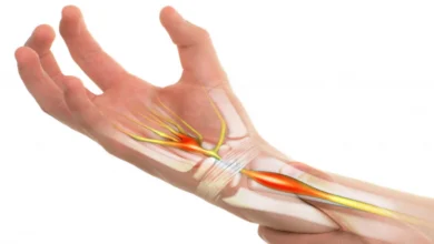 bilek ağrısına ne iyi gelir