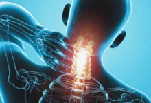 ense kökü ağrısı