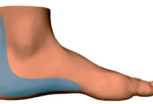 sol arka topuk ağrısı